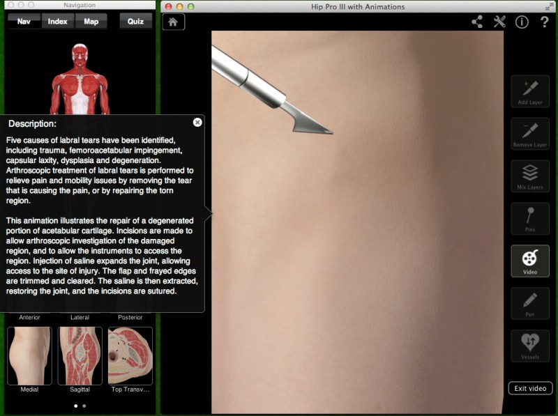 Hip Pro III - анатомия человека (бедро)